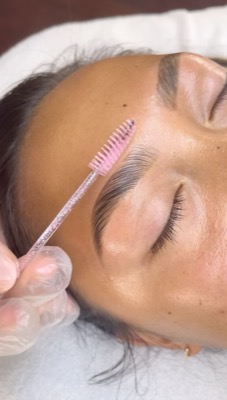 Brow Lift